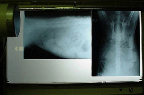Akıl Almaz Röntgen Görüntüleri! 11