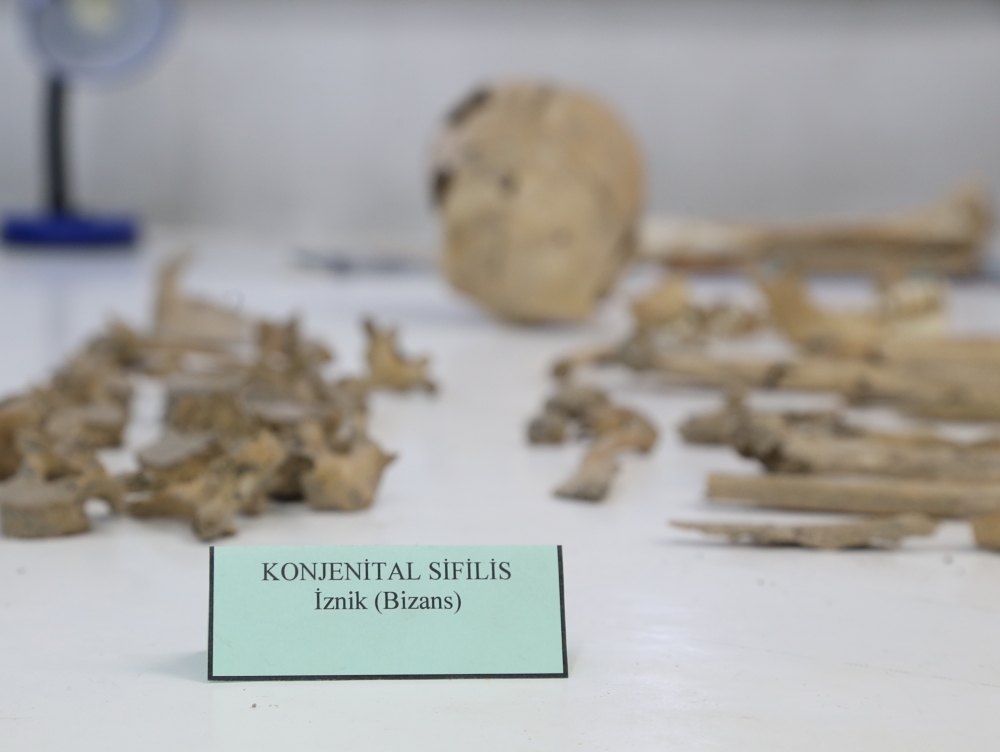 Anadolu'nun "Kemik Koleksiyonu" Tarihe Işık Tutuyor 6