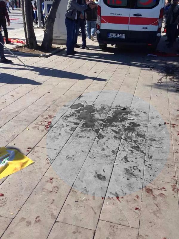 Ankara'daki Patlamadan Kan Donduran Görüntüler! 10