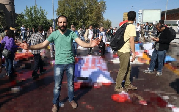 Ankara'daki Patlamadan Kan Donduran Görüntüler! 134