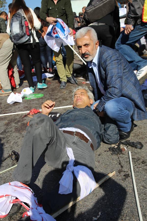 Ankara'daki Patlamadan Kan Donduran Görüntüler! 20