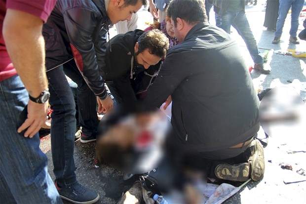 Ankara'daki Patlamadan Kan Donduran Görüntüler! 30