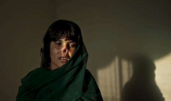 Afgan Kızı Yeni Görüntüsüne Kavuştu 14