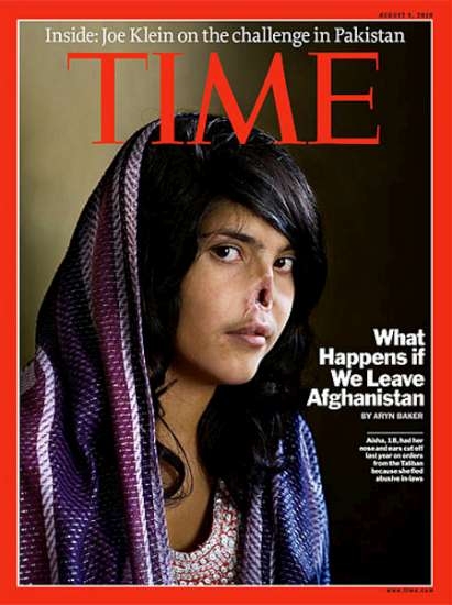 Afgan Kızı Yeni Görüntüsüne Kavuştu 4