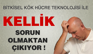 Kellik Sorun Olmaktan Çıkıyor…