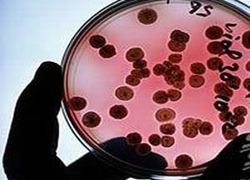 6 cep telefonundan birinde E. coli var