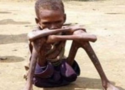 Yemen'de kıtlık uyarısı