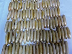 Midesinden 2 kilo 308 gram kokain çıktı