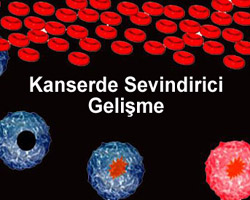 Mide kanserinde sevindiren GELİŞME