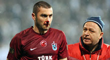 Burak'ı 2 kırığa rağmen oynatan sebep