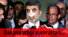 Bakana attığı yumruktan pişman oldu!
