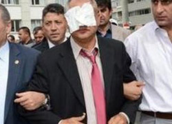 CHP'li vekile polis müdahalesi