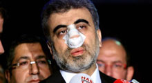 Yıldız'a yumruk davası ertelendi