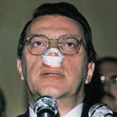 Mesut'un da burnunu kırmışlardı!