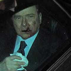Berlusconi yarın taburcu