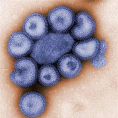 Belçika'da H1N1 virüsü vakası 4'e çıktı