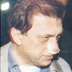 Kırık burun da Ergenekon'da!