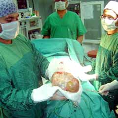 Hastanın karnından 2 kilogram ur çıktı
