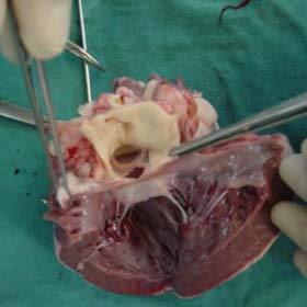 Türk doktor Kırgızistan'da ByPass ameliyatı yaptı!