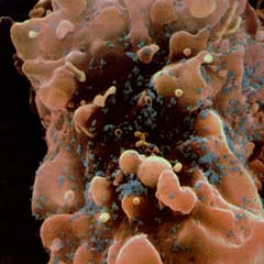 HIV'in ilk belirtileri gözden kaçıyor