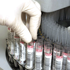 Kızılay'ın AIDS'li kanı öldürdü