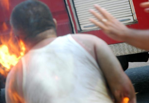 Protesto için kendini yaktı