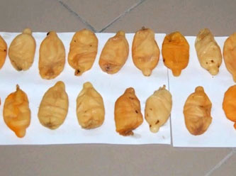 Kolombiyalı papazın midesinden 800 gram kokain çıktı