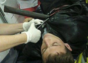 Vücuduna 2 Metrelik Demir Boru Saplandı