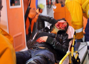 15 Yerinden Bıçaklanan Kadının Şok Kararı!
