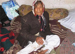 102 yaşında yaşam mücadelesi