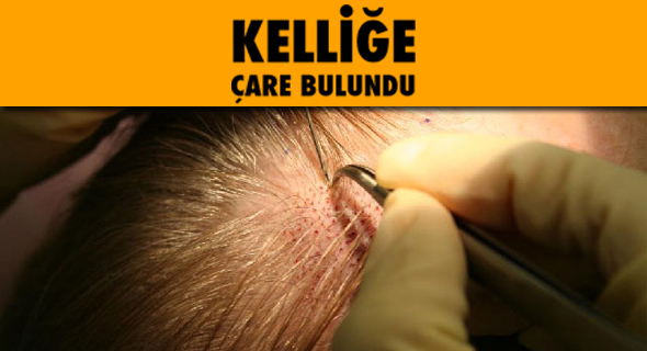 Kelliğe Çare!