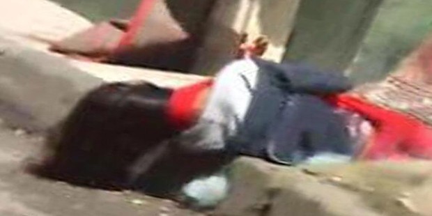 Gaz Bombası Kafatasını Kırdı, Hayatı Tehlikede