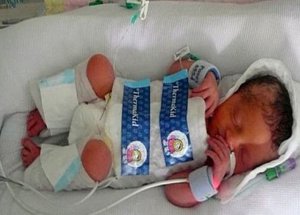 Hayata Buz Torbalarıyla Tutundu