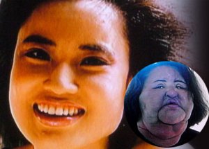 Yemeklik Yağlı Estetik Faciası!