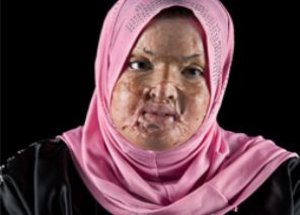 ABD’nin Irak’taki Kimyasallarının Eserleri