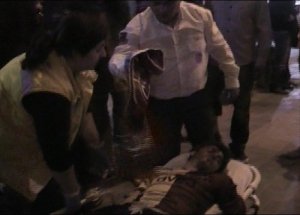 Uşak’ta derbi maçı sonrası arbede yaşandı