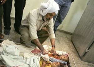 Kuruluşundan Bugüne İsrail'in Katliam Tablosu