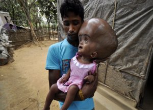 Begum Nihayet Ameliyat Oldu