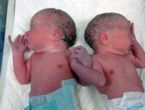 Dünya bu bebekleri konuşuyor