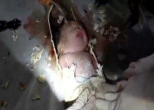 Bebeğin Kurtarıldığı Yere Bakın!