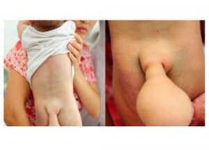 Kuyruklu Bebek Görenleri Şaşırtıyor