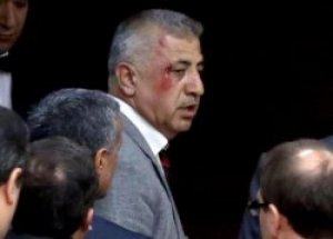 AK Parti'li Vekil Meclis'teki Kavgayı Anlattı