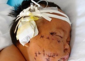 Makasla Bebeğini 90 Kez Kesti!