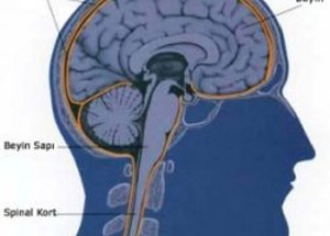 Menenjit Nedir? Nasıl Tedavi Edilir?
