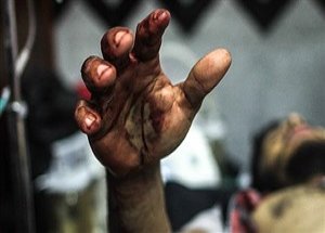 Tonlarca Kalıbın Altında Kaldılar
