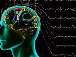 Epilepsi (Sara) Nedir? Tedavisi Nasıl Yapılır?