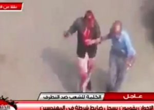 Darbe Karşıtları Yaralı Polisi Böyle Korudu