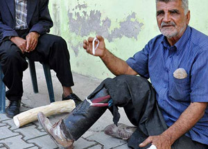 Kesik Ayağına Su Borusundan Protez Yaptı