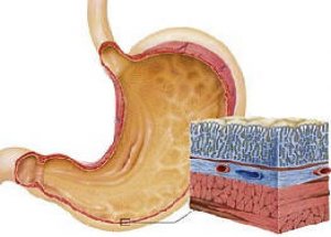 Gastrit Nedir ?