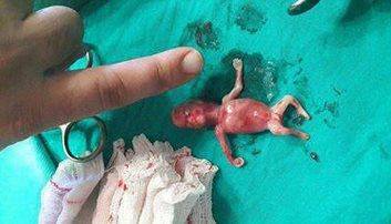 Suriye'de Hayatını Kaybeden En Küçük Canlı